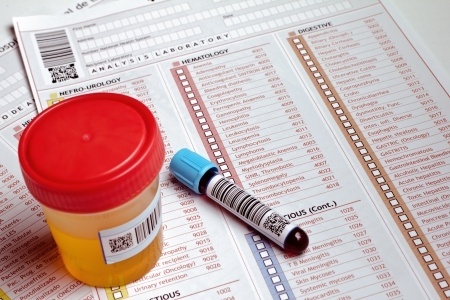 Drug alcohol testing